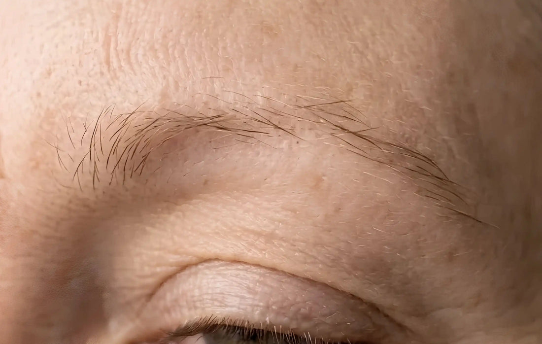 What Causes Sparse Eyebrows? The Real Reasons Behind Them